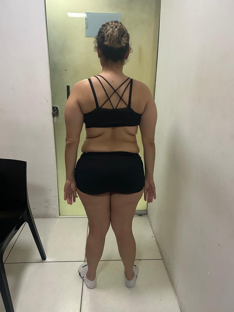 Antes da transformação